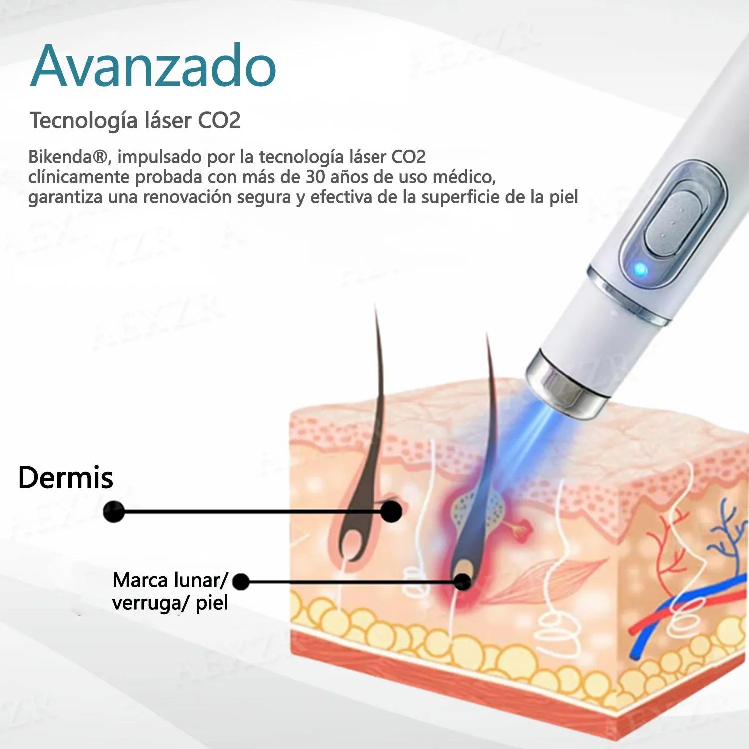 Blue Light Acne Eliminare Pen Tehnologie Neagră Instrument Non-Invaziv Laser Mole Pen Freezing Point Beauty Instrument Spot Pen Magic Instrument